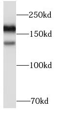 EGFR antibody