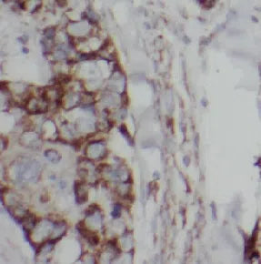 EGFR antibody
