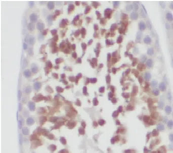 γ-H2AX antibody