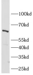 OPRM1 antibody