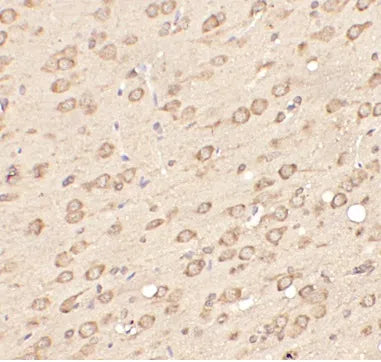 OPRM1 antibody