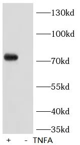 Phospho-RIPK1(Ser166) antibody