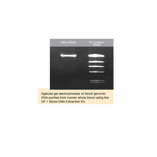 GF-1 Blood DNA Extraction Kit (Proteinase K included)