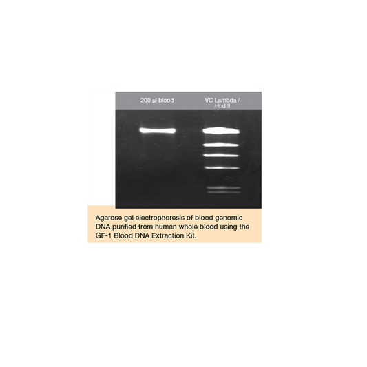 GF-1 Blood Tissue Combi DNA Extraction Kit (Proteinase K included)
