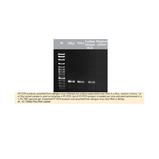 GF-1 Viral Nucleic Acid Extraction Kit (Proteinase K & Carrier RNA included)