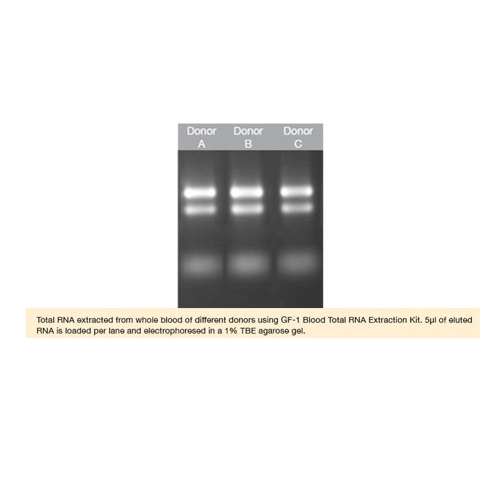 GF-1 Blood Total RNA Extraction Kit (Proteinase K & DNase I included) - Q2UB