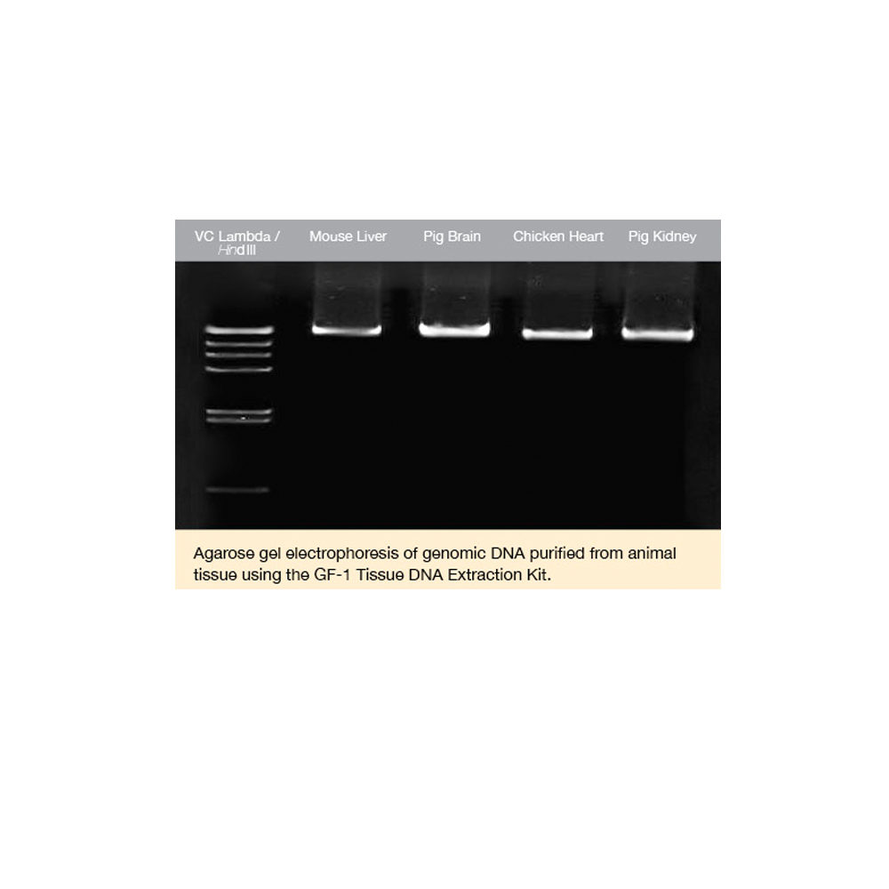 GF-1 Tissue DNA Extraction Kit (Proteinase K included) - Q2UB
