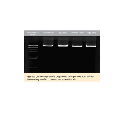GF-1 Tissue DNA Extraction Kit (Proteinase K included) - Q2UB