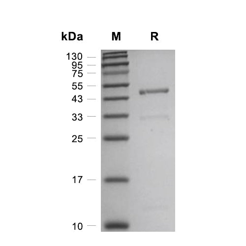 Lefty-A/TGF-beta 4 Protein, Human (HEK293, His)