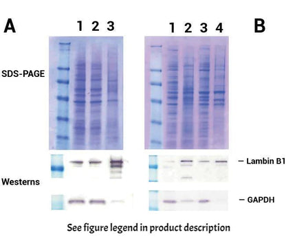 Minute TM Nuclear Envelope Protein Extraction Kit