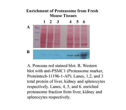 MinuteTM Cytosolic Proteasome Enrichment Kit