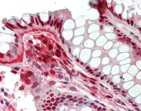anti-Nampt (Visfatin/PBEF), mAb (OMNI379)