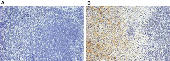 anti-Periostin, mAb (Stiny-1)