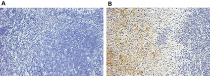 anti-Periostin, mAb (Stiny-1)