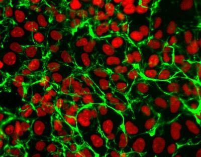 anti-Fibronectin (EDA), mAb (blocking) (IST-9) (preservative free)