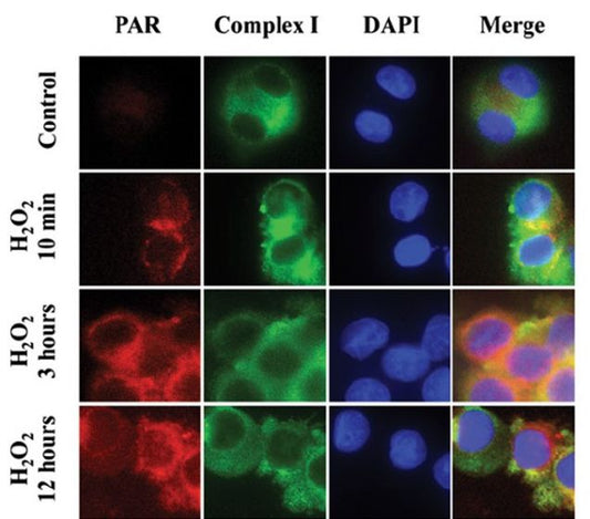 anti-Poly(ADP-ribose) [PAR], mAb (10H)