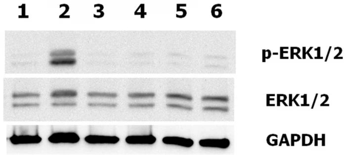 Progranulin (human) (rec.) (untagged)