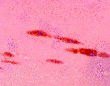 anti-Malondialdehyde [MDA], mAb (1F83)